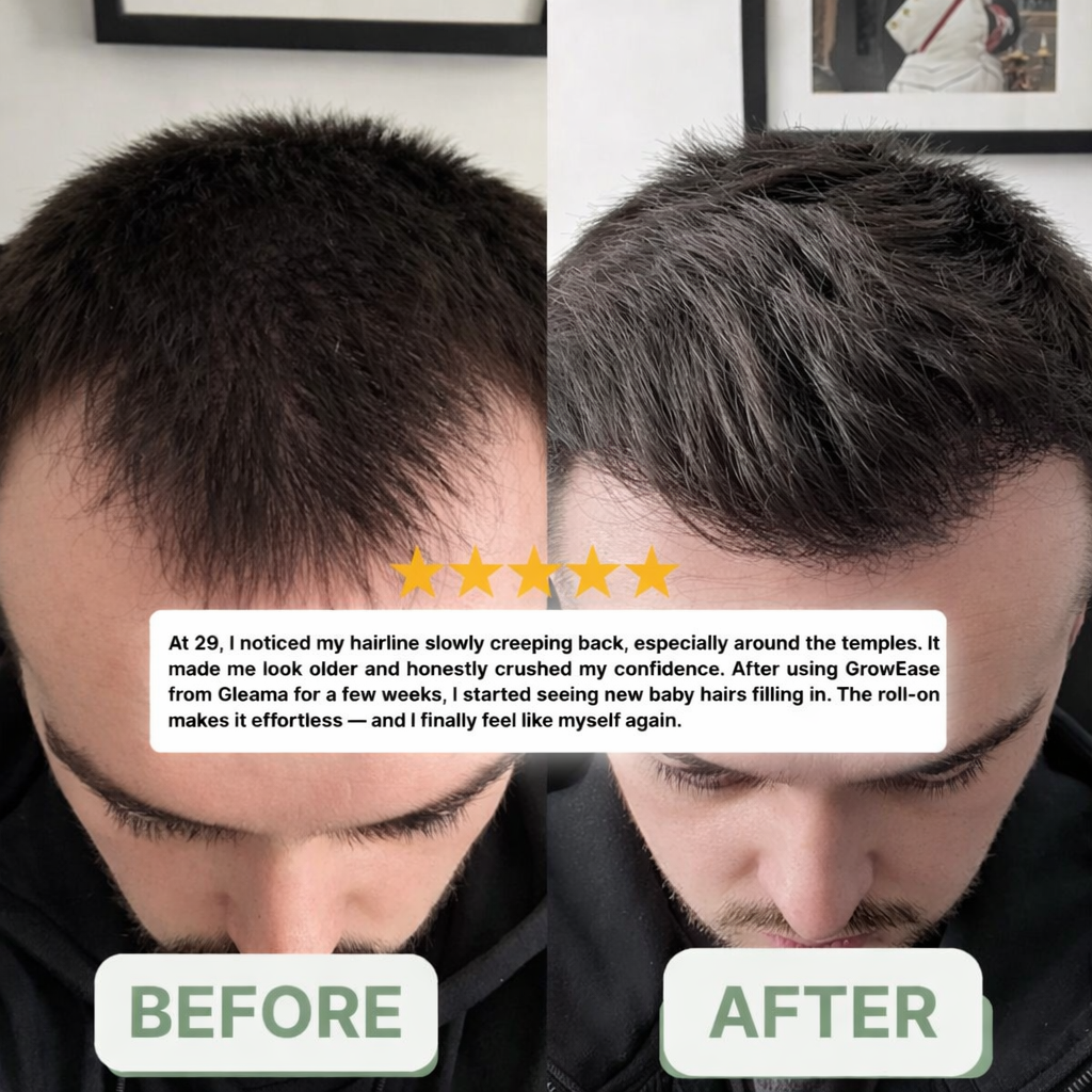 Aueral™ | Hair Growth Serum Roll-on