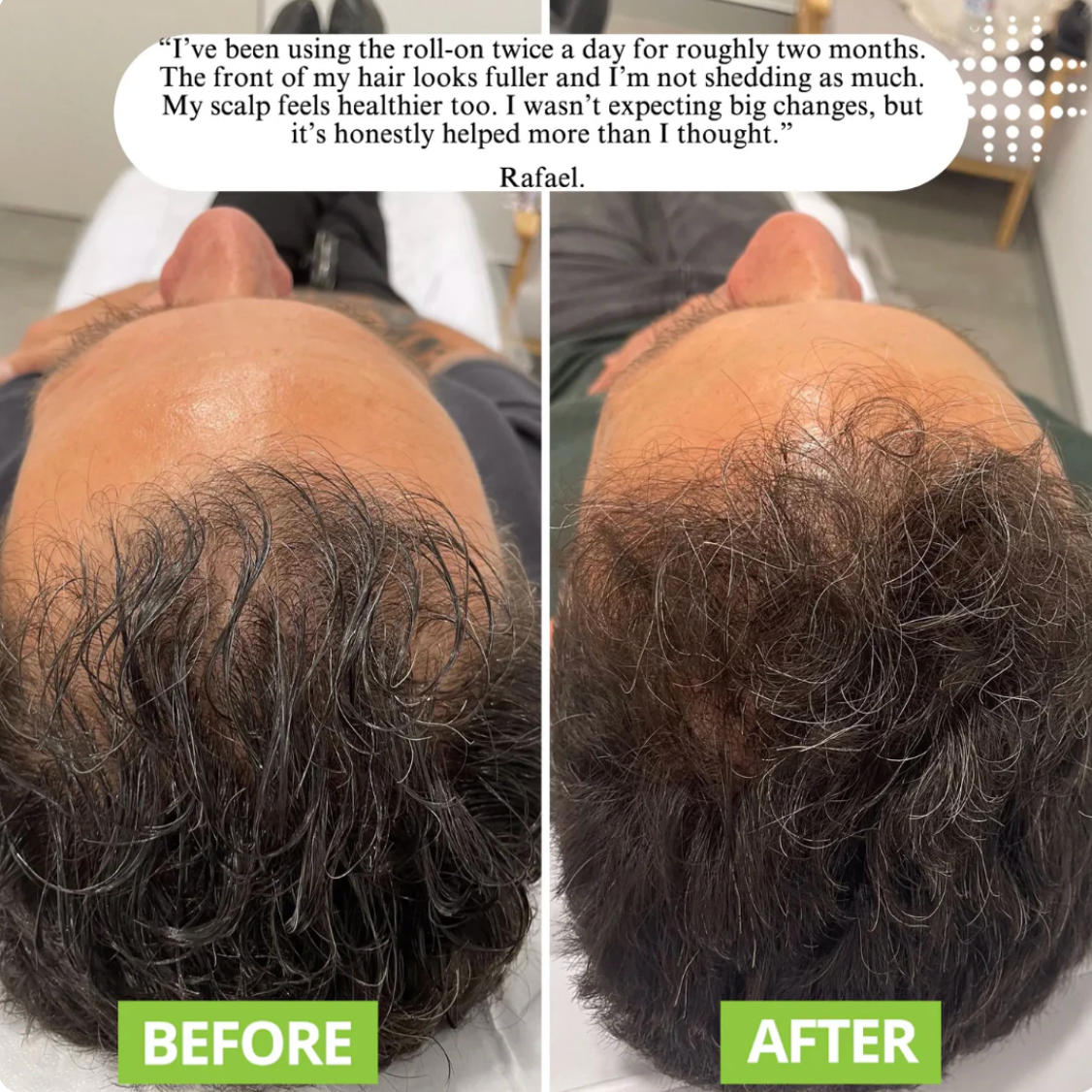 Aueral™ | Hair Growth Serum Roll-on